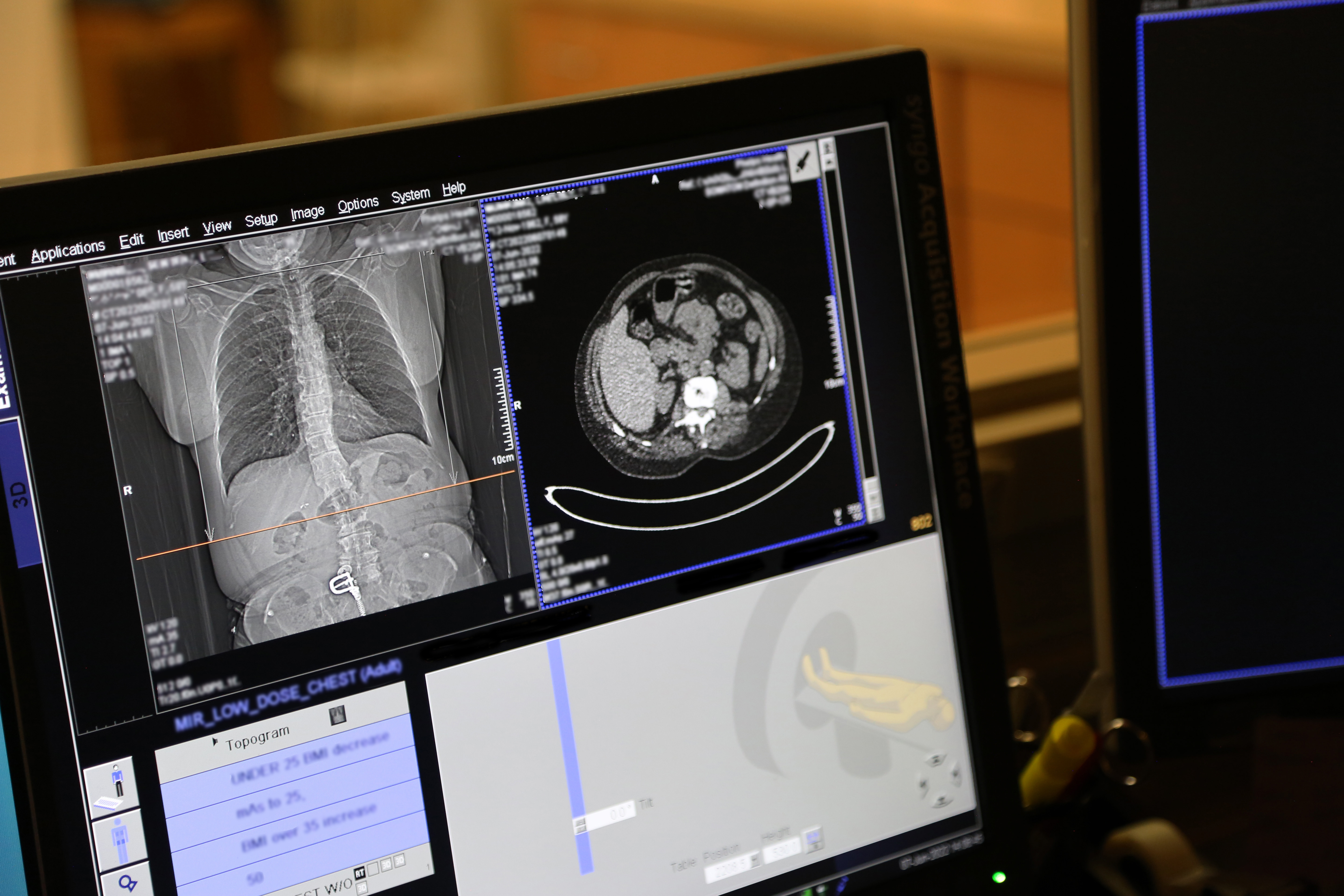 فناوری هسته‌ای، سلاحی نو در تشخیص کشنده‌ترین سرطان جهان 4